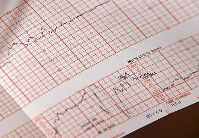 An EKG Technician can work in physician offices, hospitals, clinics, and other health care facilities and organisations. Are you wondering about EKG Technician jobs available in the Bay Area.