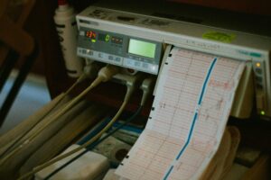 Necessary EKG equipment when EKG Technicians are in Demand.