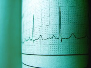 How long is EKG Technician Training?: Reading EKGs is part of the trainings